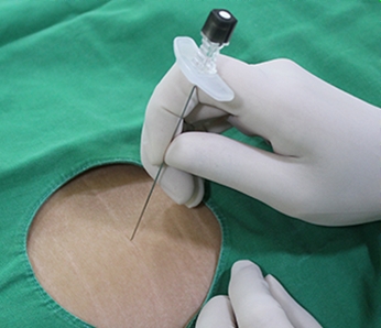 히알루론산 관절주사(무릎연골주사) 과정2