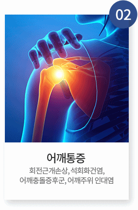 특수냉각치료(CRYO)2