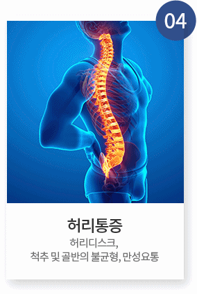 특수냉각치료(CRYO)4