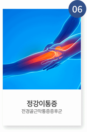 특수냉각치료(CRYO)2